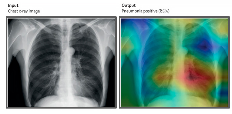 radiografias IA
